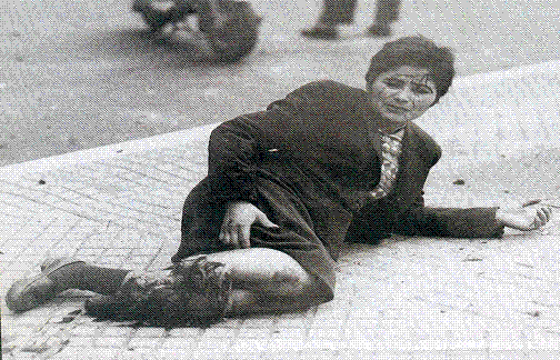 Mujer con su pierna destrozada durante el bombardeo a Plaza de Mayo el 16 de junio de 1955.
